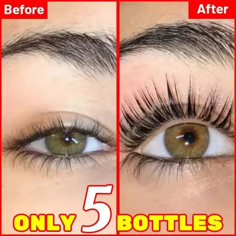 7 Dagen Snelle Wimpergroei Ser - Lash Serum Growth recensie en prijs
